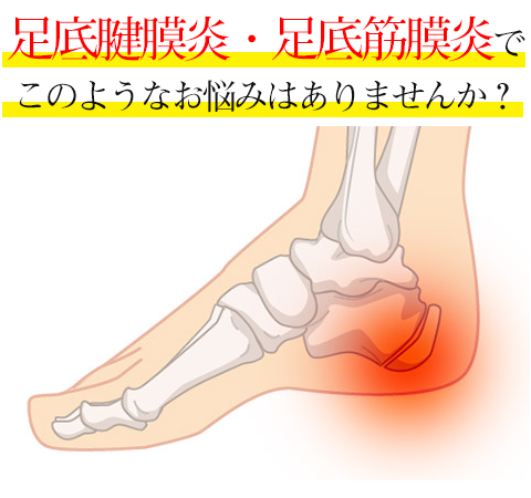足底腱膜炎足底筋膜炎でこのようなお悩みはありませんか？